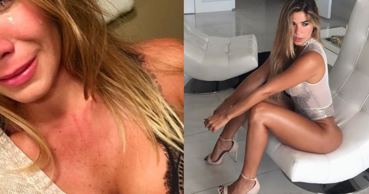 Modelka otvorene prehovorila o svojom expriateľovi: „Dva roky ma týral!“