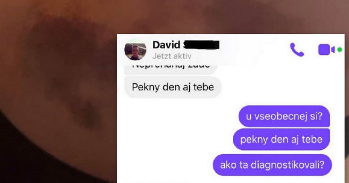 Jej 25-ročný syn spadol na snowboarde a skončil v nemocnici. Tak písal SMS