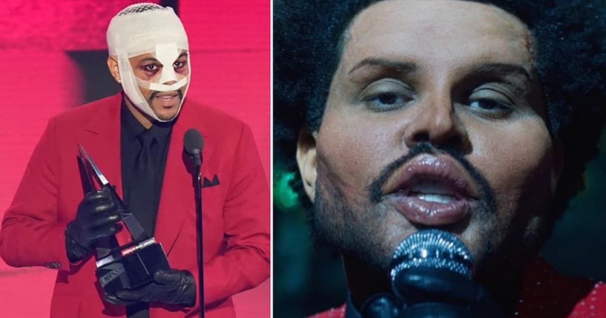The Weeknd odhalil nový klip aj novú tvár. Fanúšikovia sú v šoku, naozaj podstúpil plastickú operáciu?
